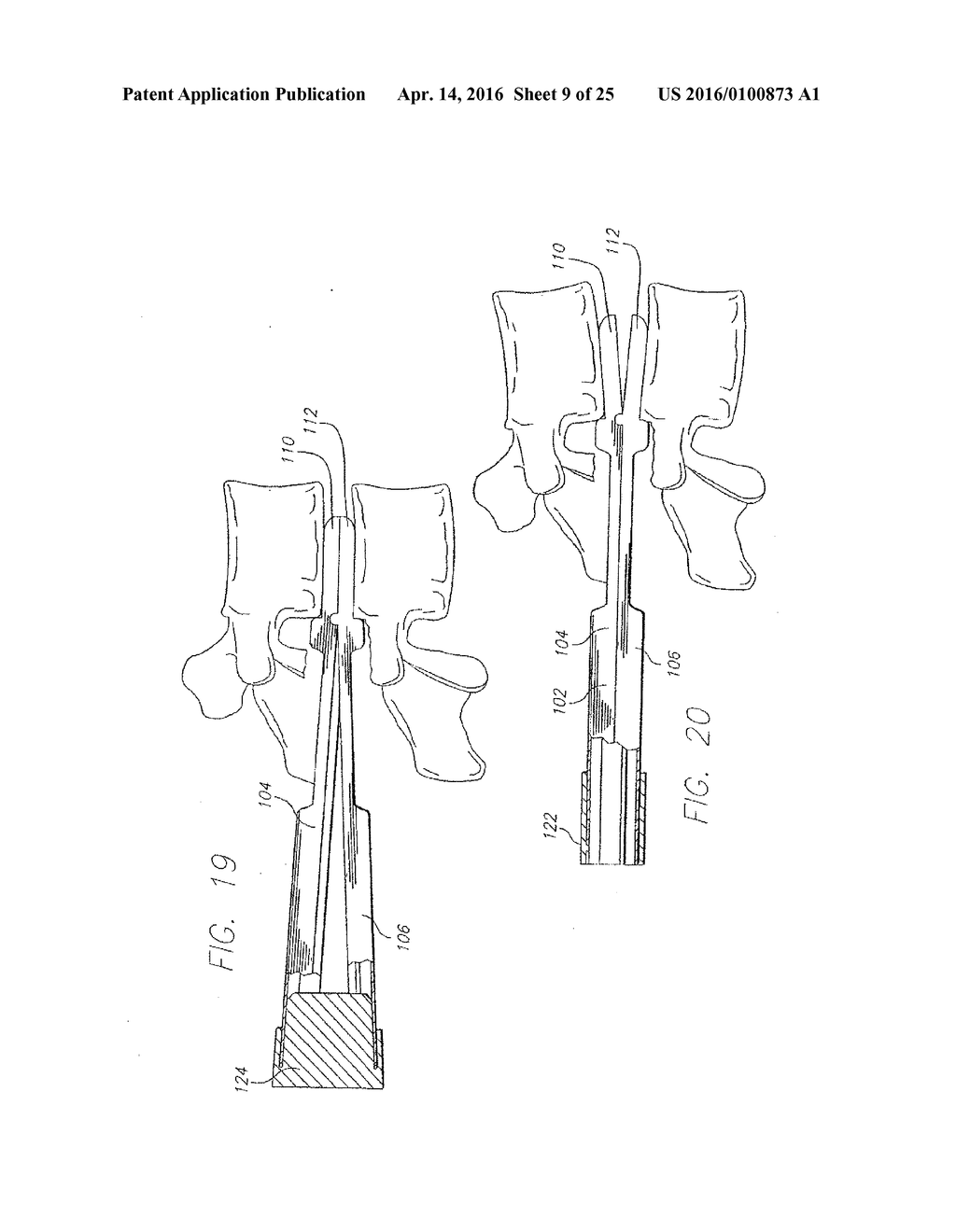 Method for Using a Guard for Creating a Socket Posteriorly in the Spine - diagram, schematic, and image 10