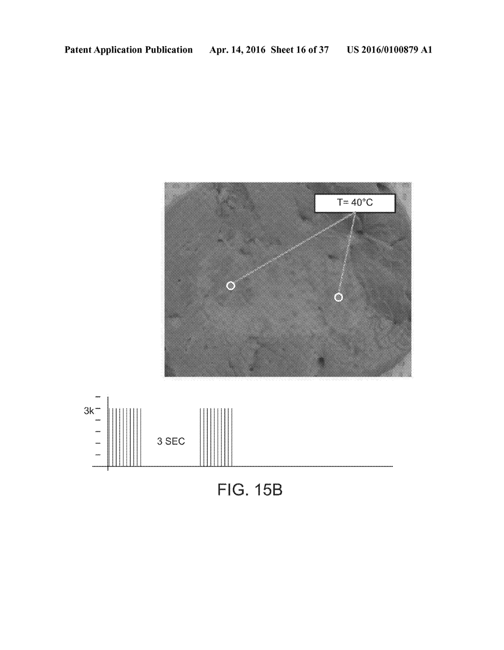 ELECTRICAL ABLATION DEVICES AND METHODS - diagram, schematic, and image 17