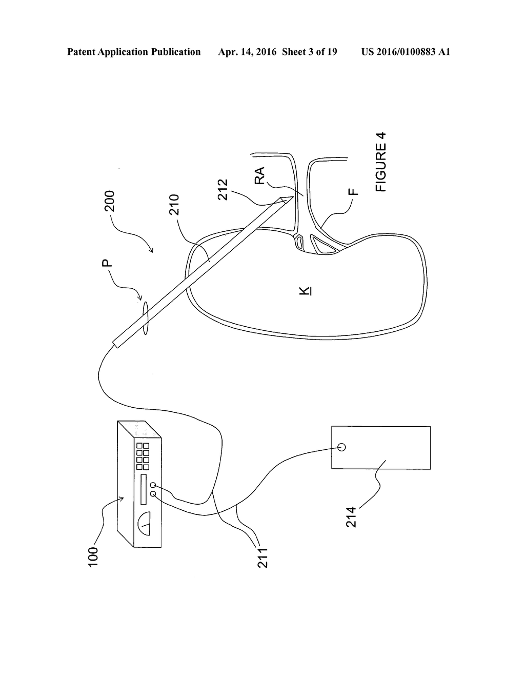 Methods and Apparatus for Renal Neuromodulation - diagram, schematic, and image 04