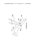 Methods and Apparatus for Renal Neuromodulation diagram and image