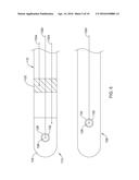 TISSUE DIAGNOSIS AND TREATMENT USING MINI-ELECTRODES diagram and image