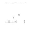 TISSUE DIAGNOSIS AND TREATMENT USING MINI-ELECTRODES diagram and image