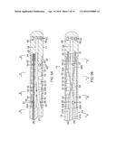 CATHETER FOR TREATMENT OF ATRIAL FLUTTER HAVING SINGLE ACTION DUAL     DEFLECTION MECHANISM diagram and image