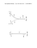 CATHETER FOR TREATMENT OF ATRIAL FLUTTER HAVING SINGLE ACTION DUAL     DEFLECTION MECHANISM diagram and image