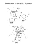 DENTAL EXPANSION ASSEMBLY diagram and image