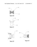 DENTAL ORAL SHIELD DEVICE AND SYSTEM diagram and image