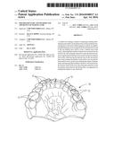 MOLDED DENTURE AND METHOD AND APPARATUS OF MAKING SAME diagram and image