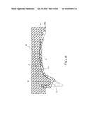 MOLDED DENTURE AND METHOD AND APPARATUS OF MAKING SAME diagram and image