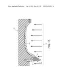 MOLDED DENTURE AND METHOD AND APPARATUS OF MAKING SAME diagram and image