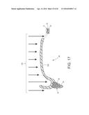 MOLDED DENTURE AND METHOD AND APPARATUS OF MAKING SAME diagram and image