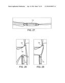 METHODS AND SYSTEMS FOR FORMING UNICOMPARTMENTAL AND UNICONDYLAR KNEE     RESURFACING IN CONJUNCTION WITH CRUCIATE LIGAMENT REPLACEMENT     CONCOMITANTLY diagram and image