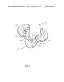 GRAFT FIXATION diagram and image