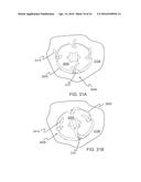 GRAFT FIXATION diagram and image