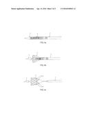 ELECTRIC HANDLE FOR IMPLANT DELIVERY AND DELIVERY SYSTEM diagram and image