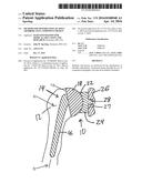 Method for Optimization of Joint Arthroplasty Component Design diagram and image