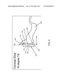 Method for Optimization of Joint Arthroplasty Component Design diagram and image