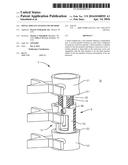 SPINAL IMPLANT SYSTEM AND METHOD diagram and image