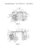 SPINAL IMPLANT SYSTEM AND METHOD diagram and image