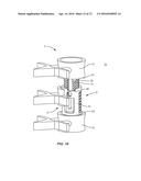 SPINAL IMPLANT SYSTEM AND METHOD diagram and image