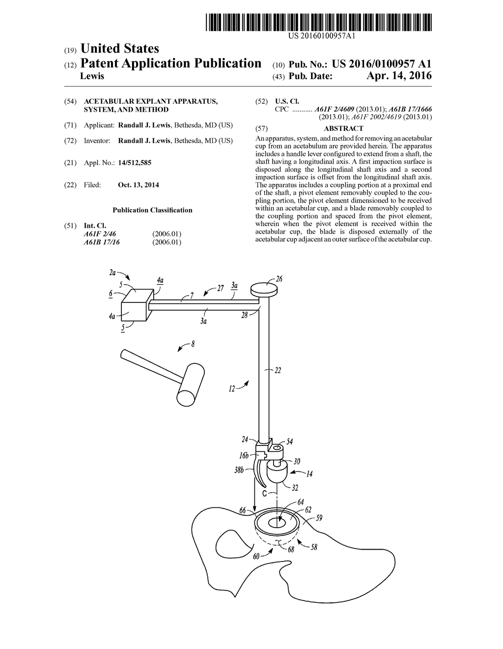 ACETABULAR EXPLANT APPARATUS, SYSTEM, AND METHOD - diagram, schematic, and image 01