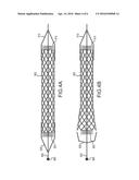 METHODS AND APPARATUS FOR LUMINAL STENTING diagram and image