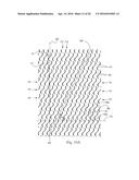 ABSORBENT ARTICLE WITH FASTENING SYSTEM diagram and image