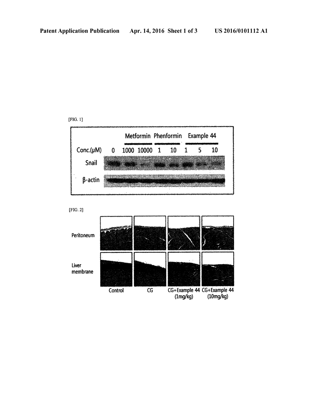 PHARMACEUTICAL COMPOSITION COMPRISING N1-CYCLIC AMINE-N5-SUBSTITUTED     BIGUANIDE DERIVATIVES AS AN INGREDIENT FOR PREVENTING OR TREATING     FIBROSIS - diagram, schematic, and image 02