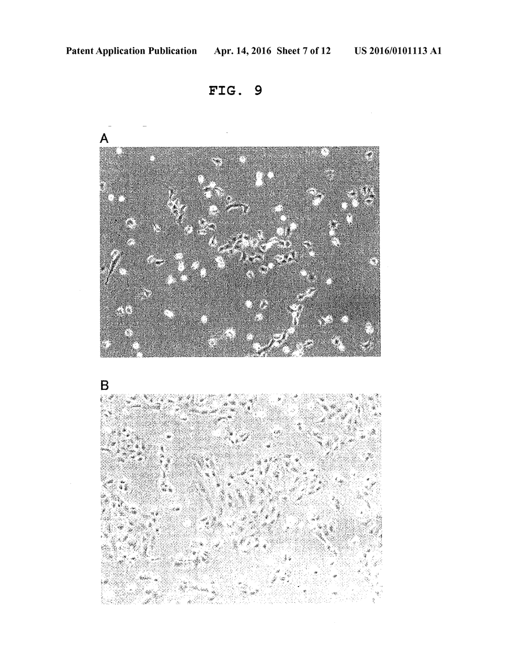 AGENT FOR PROMOTING CORNEAL ENDOTHELIAL CELL ADHESION - diagram, schematic, and image 08