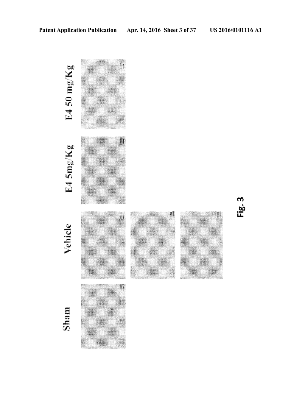 ESTROGENIC COMPONENTS FOR USE IN THE TREATMENT OF NEUROLOGICAL DISORDERS - diagram, schematic, and image 04