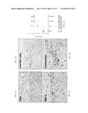 TREATMENT OF CANCER USING TLR9 AGONIST WITH CHECKPOINT INHIBITORS diagram and image