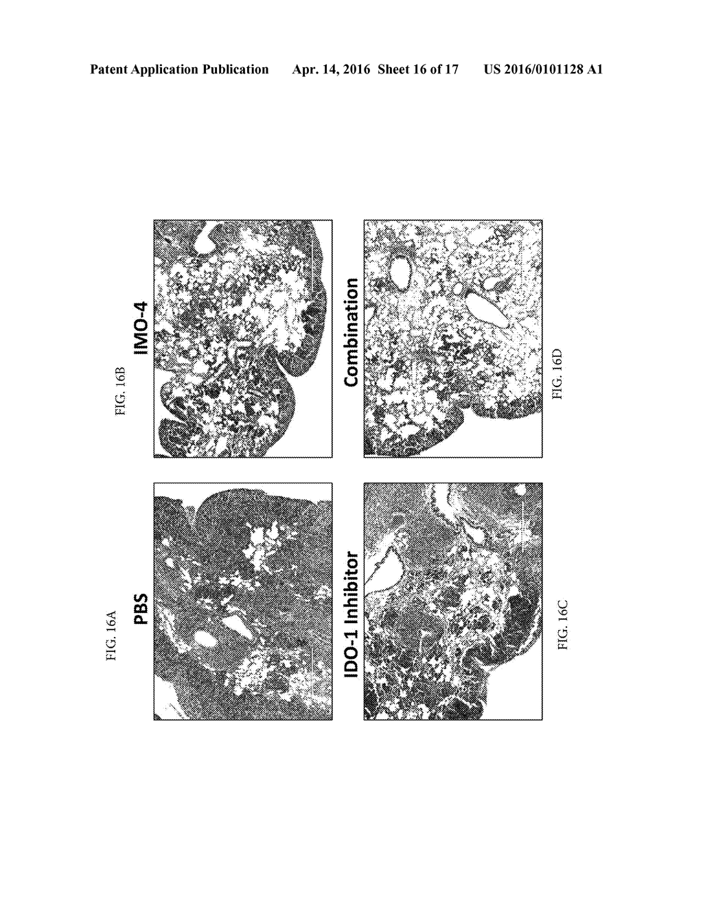 TREATMENT OF CANCER USING TLR9 AGONIST WITH CHECKPOINT INHIBITORS - diagram, schematic, and image 17