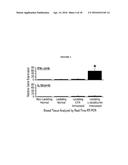 Breast Cancer Vaccine diagram and image