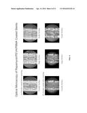 COATINGS CONTAINING MULTIPLE DRUGS diagram and image