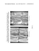 COATINGS CONTAINING MULTIPLE DRUGS diagram and image