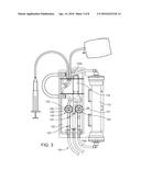 Sensing Negative Pressure with a Pressure Transducer diagram and image