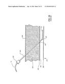 MEDICAL GUIDE ELEMENT WITH DIAMETER TRANSITION diagram and image