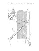 MEDICAL GUIDE ELEMENT WITH DIAMETER TRANSITION diagram and image