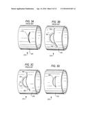 MEDICAL GUIDE ELEMENT WITH DIAMETER TRANSITION diagram and image