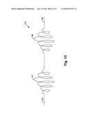 Anchoring Device and Methods for Use diagram and image