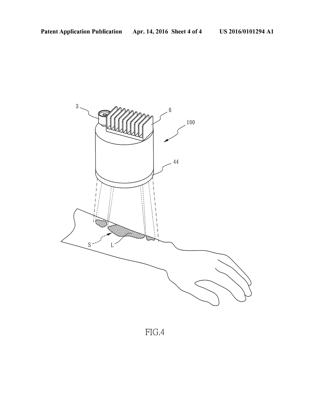 PORTABLE PHOTOTHERAPY APPARATUS FOR PSORIASIS - diagram, schematic, and image 05