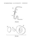 GOLF CLUB HEAD WITH FLEXURE diagram and image