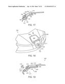 GOLF CLUB HAVING REMOVABLE WEIGHT diagram and image