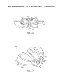 GOLF CLUB HAVING REMOVABLE WEIGHT diagram and image