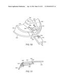 GOLF CLUB HAVING REMOVABLE WEIGHT diagram and image