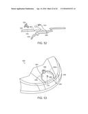 GOLF CLUB HAVING REMOVABLE WEIGHT diagram and image