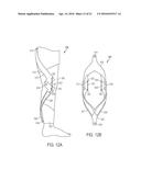 Electrolaminate Clutches for an Exosuit System diagram and image