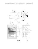 SYSTEMS AND METHODS FOR GENERATING ORTHOTIC DEVICE MODELS BY SURFACE     MAPPING AND EXTRUSION diagram and image