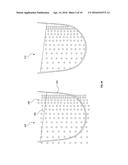 SYSTEMS AND METHODS FOR GENERATING ORTHOTIC DEVICE MODELS BY SURFACE     MAPPING AND EXTRUSION diagram and image