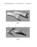 SYSTEMS AND METHODS FOR GENERATING ORTHOTIC DEVICE MODELS BY SURFACE     MAPPING AND EXTRUSION diagram and image