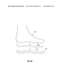 SYSTEMS AND METHODS FOR GENERATING ORTHOTIC DEVICE MODELS BY SURFACE     MAPPING AND EXTRUSION diagram and image